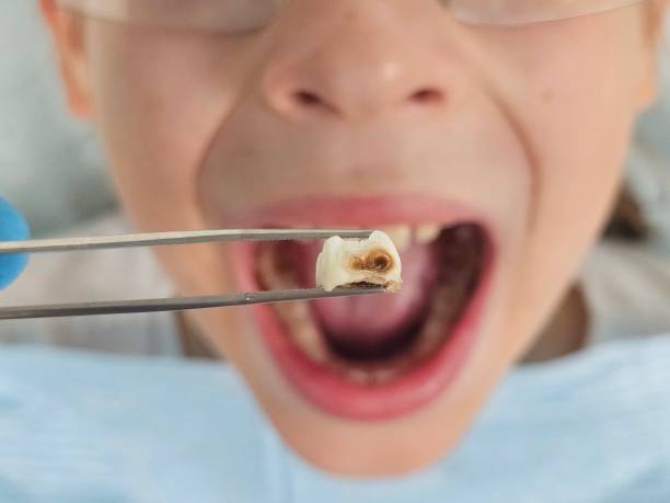 Best Broken Tooth Emergency  in Montpelier, VT