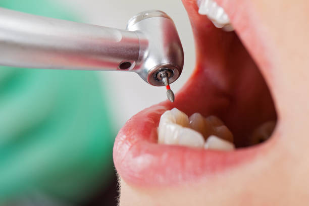 Best Cracked Tooth Emergency Dentist  in Montpelier, VT